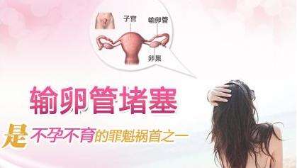 警惕！输卵管通而不畅